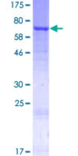 Abnova Human GAL3ST1 Full-length ORF (AAH14649.1, 1 a.a. - 423 a.a.) Recombinant Protein with GST-tag at N-terminal 2 &mu;g | Buy Online | Abnova&trade; | Fisher Scientific