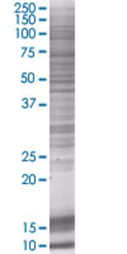 Abnova GOSR1 293T Cell Transient Overexpression Lysate (Denatured) 100 &mu;L | Buy Online | Abnova&trade; | Fisher Scientific