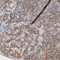 MSL2 Rabbit anti-Human, Polyclonal , Abnova 100 &mu;L | Buy Online | Abnova | Fisher Scientific