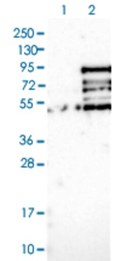 MSL2 Rabbit anti-Human, Polyclonal , Abnova 100 &mu;L | Buy Online | Abnova | Fisher Scientific