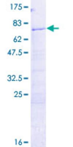 Abnova Human H2AFY Full-length ORF (NP_613258.2, 1 a.a. - 372 a.a.) Recombinant Protein with GST-tag at N-terminal 2 &mu;g | Buy Online | Abnova&trade; | Fisher Scientific