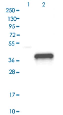 GZMB Rabbit anti-Human, Polyclonal , Abnova 100 &mu;L | Buy Online | Abnova Corporation | Fisher Scientific