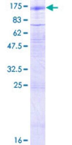 Abnova Human GABBR2 Full-length ORF (AAH35071.2, 1 a.a. - 883 a.a.) Recombinant Protein with GST-tag at N-terminal 25 &mu;g | Buy Online | Abnova&trade; | Fisher Scientific
