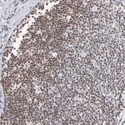 MAX Rabbit anti-Human, Polyclonal , Abnova 100 &mu;L | Buy Online | Abnova | Fisher Scientific