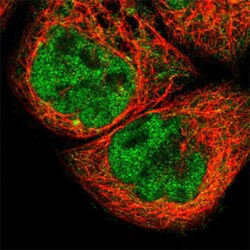 MAX Rabbit anti-Human, Polyclonal , Abnova 100 &mu;L | Buy Online | Abnova | Fisher Scientific