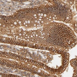 CDH1 Rabbit anti-Human, Polyclonal , Abnova 100&mu;L; Unlabeled:Antibodies,