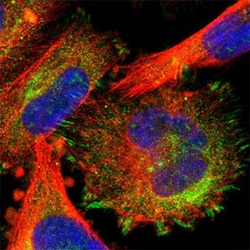 CDH1 Rabbit anti-Human, Polyclonal , Abnova 100&mu;L; Unlabeled:Antibodies,
