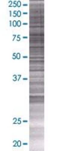 Abnova SNCAIP 293T Cell Transient Overexpression Lysate (Denatured) (T01) 100 &mu;L | Buy Online | Abnova&trade; | Fisher Scientific