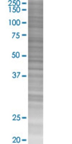 Abnova MTFR1 293T Cell Transient Overexpression Lysate (Denatured) (T03) 100 &mu;L | Buy Online | Abnova&trade; | Fisher Scientific