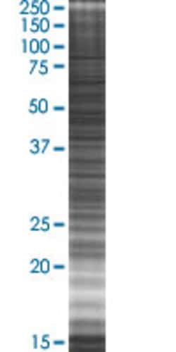 Abnova UBE3C 293T Cell Transient Overexpression Lysate (Denatured) (T02) 100 &mu;L | Buy Online | Abnova&trade; | Fisher Scientific