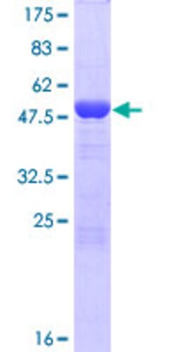 Abnova Human ECE2 Full-length ORF (NP_115707.1, 1 a.a. - 255 a.a.) Recombinant Protein with GST-tag at N-terminal 10 &mu;g | Buy Online | Abnova&trade; | Fisher Scientific