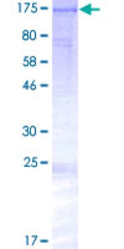 Abnova Human KIAA0256 Full-length ORF (NP_055516.2, 1 a.a. - 1056 a.a.) Recombinant Protein with GST-tag at N-terminal 2 &mu;g | Buy Online | Abnova&trade; | Fisher Scientific