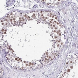 ANLN Rabbit anti-Human, Polyclonal , Abnova 100&mu;L; Unlabeled:Antibodies,