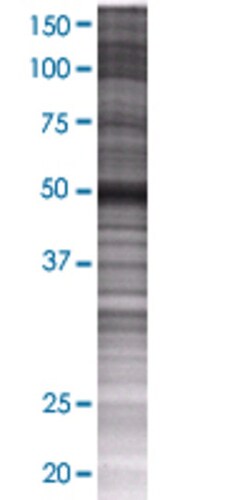 Abnova ARHGAP25 293T Cell Transient Overexpression Lysate (Denatured) 100 &mu;L | Buy Online | Abnova&trade; | Fisher Scientific