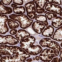 PCK2 Rabbit anti-Human, Polyclonal , Abnova 100&mu;L; Unlabeled:Antibodies,