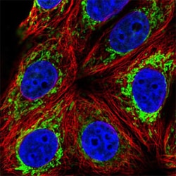 PCK2 Rabbit anti-Human, Polyclonal , Abnova 100&mu;L; Unlabeled:Antibodies,