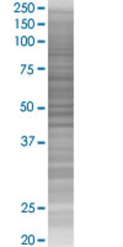 Abnova REC8L1 (pCD) 293T Cell Transient Overexpression Lysate (Denatured) 100 &mu;l | Buy Online | Abnova&trade; | Fisher Scientific