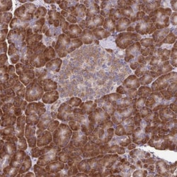 RNF10 Rabbit anti-Human, Polyclonal , Abnova 100&mu;L; Unlabeled:Antibodies,