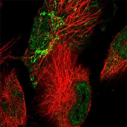 RNF10 Rabbit anti-Human, Polyclonal , Abnova 100&mu;L; Unlabeled:Antibodies,