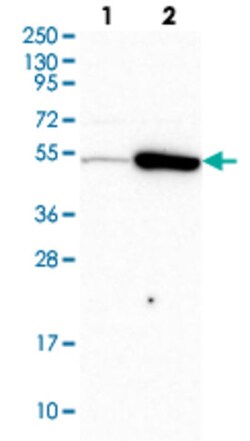 TRIP6 Rabbit anti-Human, Polyclonal , Abnova 100&mu;L; Unlabeled:Antibodies,