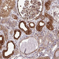 TRIP6 Rabbit anti-Human, Polyclonal , Abnova 100&mu;L; Unlabeled:Antibodies,