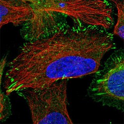 TRIP6 Rabbit anti-Human, Polyclonal , Abnova 100&mu;L; Unlabeled:Antibodies,