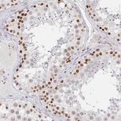 RCOR1 Rabbit anti-Human, Polyclonal , Abnova 100&mu;L; Unlabeled:Antibodies,