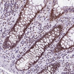 CLK2 Rabbit anti-Human, Polyclonal , Abnova 100 &mu;L | Buy Online | Abnova Corporation | Fisher Scientific
