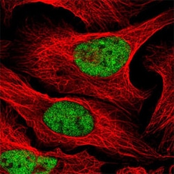 CLK2 Rabbit anti-Human, Polyclonal , Abnova 100 &mu;L | Buy Online | Abnova Corporation | Fisher Scientific