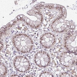 ELF4 Rabbit anti-Human, Polyclonal , Abnova 100&mu;L; Unlabeled:Antibodies,