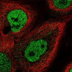 ELF4 Rabbit anti-Human, Polyclonal , Abnova 100&mu;L; Unlabeled:Antibodies,