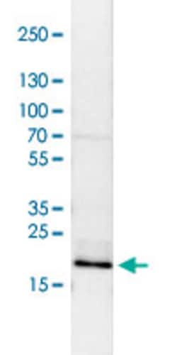 GAR1 Rabbit anti-Human, Polyclonal , Abnova 100&mu;L; Unlabeled:Antibodies,