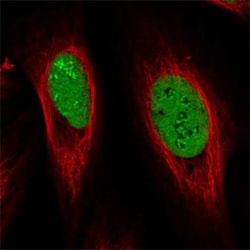 GAR1 Rabbit anti-Human, Polyclonal , Abnova 100&mu;L; Unlabeled:Antibodies,