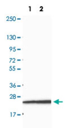 GFPT2 Rabbit anti-Human, Polyclonal , Abnova 100&mu;L; Unlabeled:Antibodies,