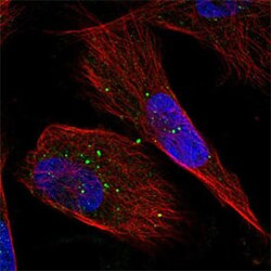 GFPT2 Rabbit anti-Human, Polyclonal , Abnova 100&mu;L; Unlabeled:Antibodies,