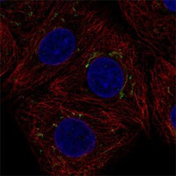 AIG1 Rabbit anti-Human, Polyclonal , Abnova 100&mu;L; Unlabeled:Antibodies,