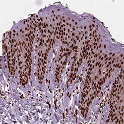 BRD4 Rabbit anti-Human, Polyclonal , Abnova 100&mu;L; Unlabeled:Antibodies,