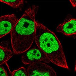 BRD4 Rabbit anti-Human, Polyclonal , Abnova 100&mu;L; Unlabeled:Antibodies,
