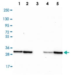 TPD52 Rabbit anti-Human, Polyclonal , Abnova 100&mu;L; Unlabeled:Antibodies,