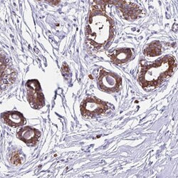 TPD52 Rabbit anti-Human, Polyclonal , Abnova 100&mu;L; Unlabeled:Antibodies,