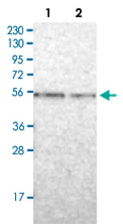 ENTPD1 Rabbit anti-Human, Polyclonal , Abnova 100&mu;L; Unlabeled:Antibodies,