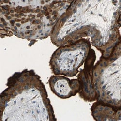 ENTPD1 Rabbit anti-Human, Polyclonal , Abnova 100&mu;L; Unlabeled:Antibodies,