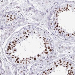 TCF3 Rabbit anti-Human, Polyclonal , Abnova 100&mu;L; Unlabeled:Antibodies,