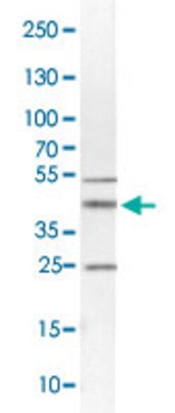 SYP Rabbit anti-Human, Polyclonal , Abnova 100&mu;L; Unlabeled:Antibodies,
