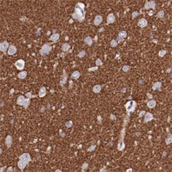 SYP Rabbit anti-Human, Polyclonal , Abnova 100&mu;L; Unlabeled:Antibodies,
