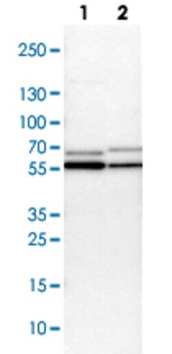 CCT2 Rabbit anti-Human, Mouse, Rat, Polyclonal Antibody, Abnova 100&mu;L;