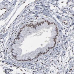 ATF7 Rabbit anti-Human, Polyclonal , Abnova 100&mu;L; Unlabeled:Antibodies,