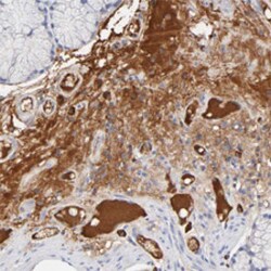 PLAT Rabbit anti-Human, Polyclonal , Abnova 100&mu;L; Unlabeled:Antibodies,