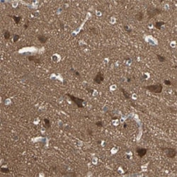 TNFRSF21 Rabbit anti-Human, Polyclonal , Abnova 100&mu;L; Unlabeled:Antibodies,