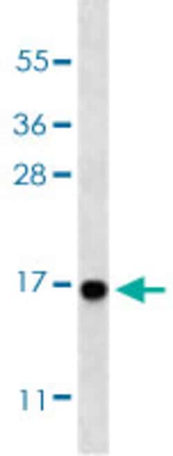 MAP1LC3A (Cleaved) Rabbit anti-Human, Mouse, Polyclonal , Abnova 400 &mu;L | Buy Online | Abnova Corporation | Fisher Scientific